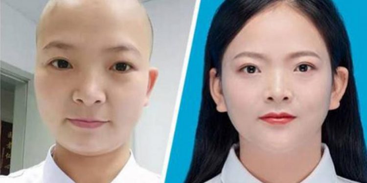 Những hình ảnh xúc động của bác sĩ Vũ Hán mặt hằn khẩu trang, nữ đầu cạo trọc vì chống dịch corona